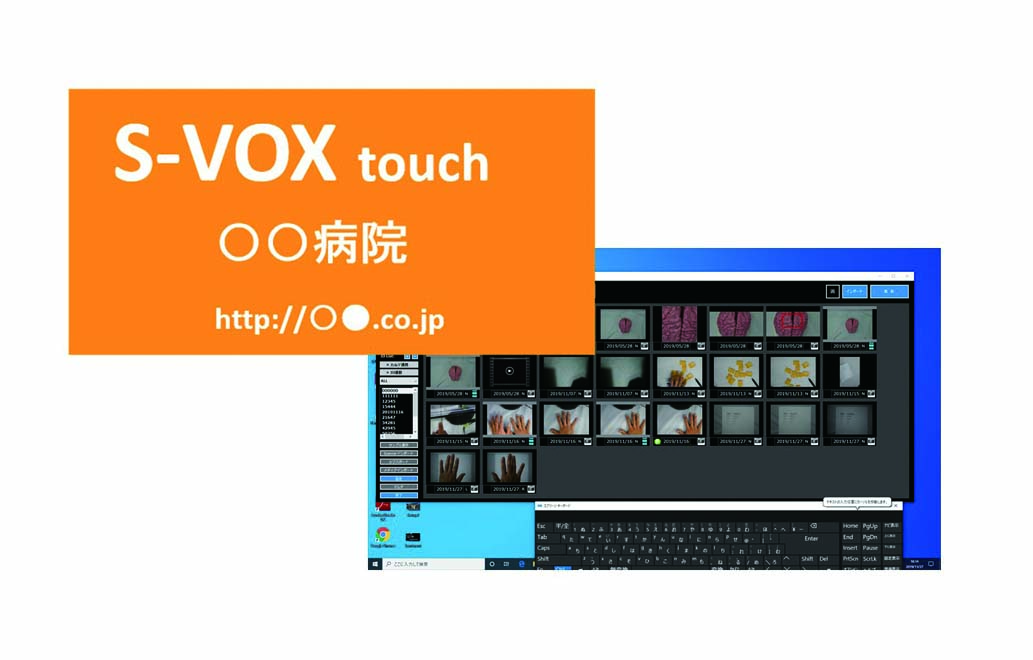 マクロデジタル撮影装置<br />S-VOX